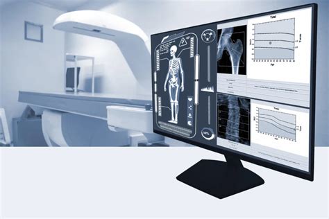 dexa scan singapore cost